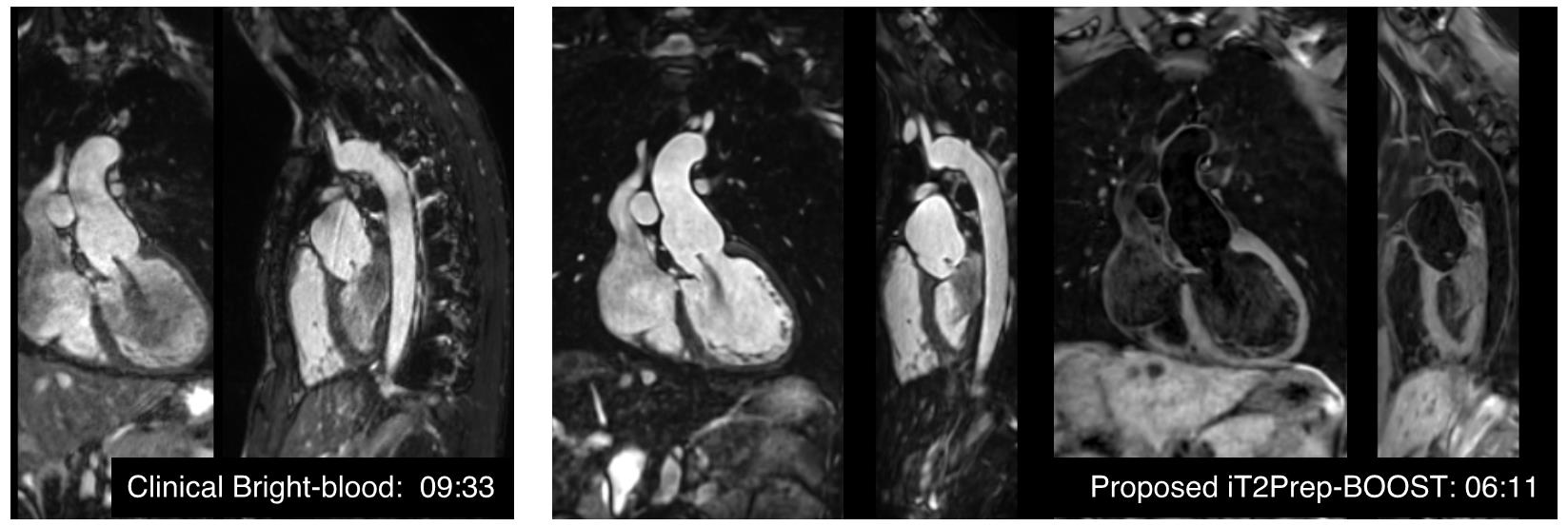 MT-prepared BOOST PSIR example