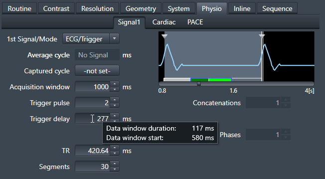 Physio tab acquisition window example